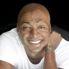 JR-Martinez